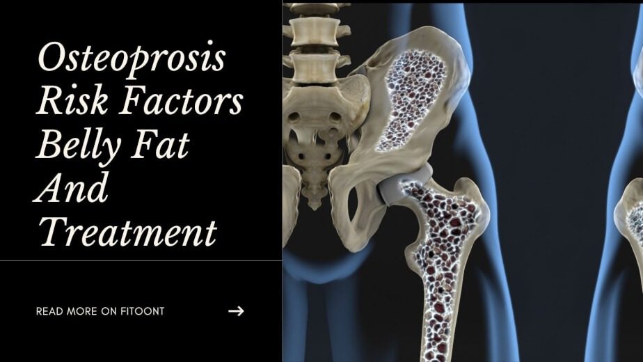 Osteoprosis Risk Factors Belly Fat And Treatment - Fitoont