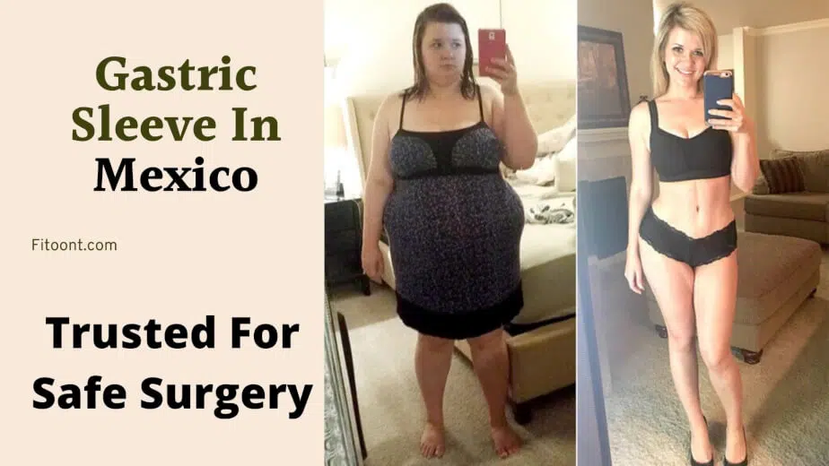 Gastric Sleeve In Mexico: Trusted For Safe Surgery - Fitoont