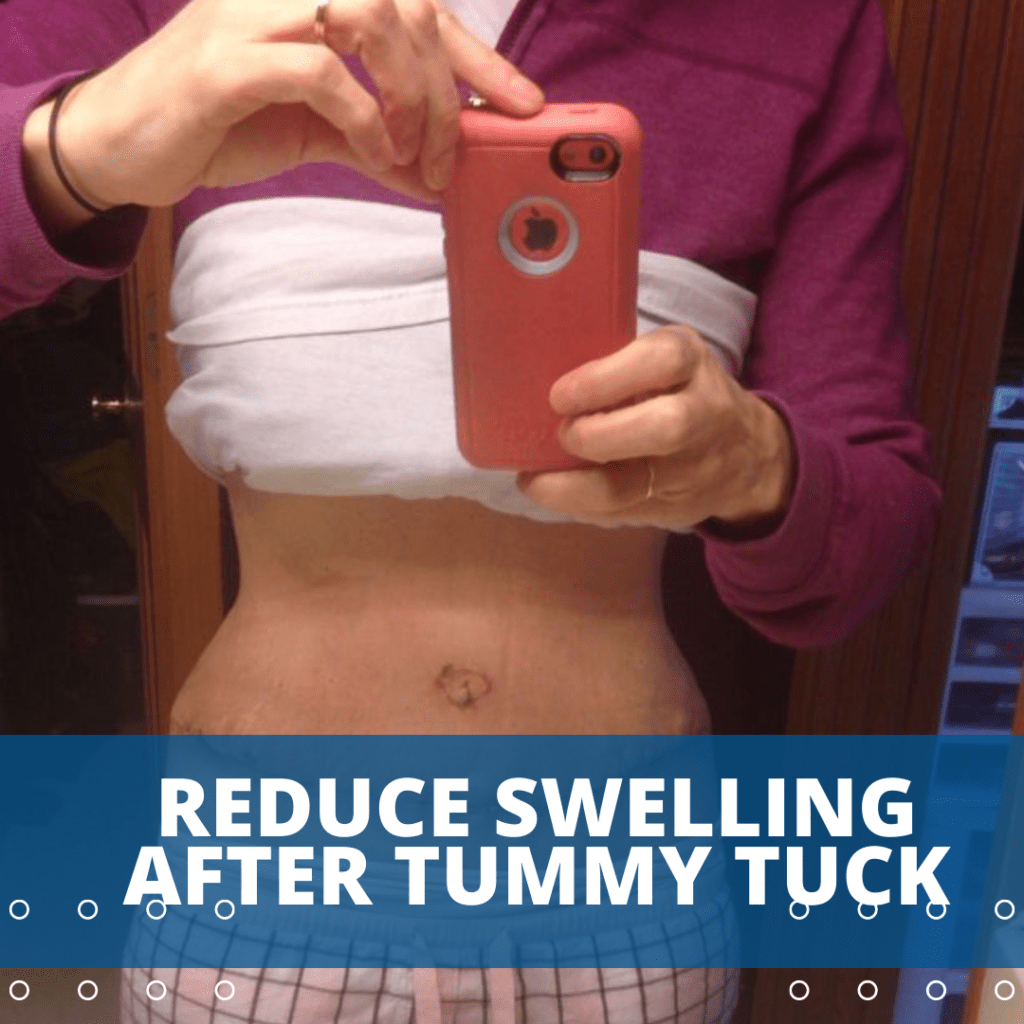 picture swelling after tummy tuck