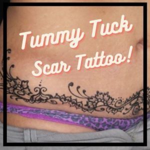 tummy tuck scar tattoo pics