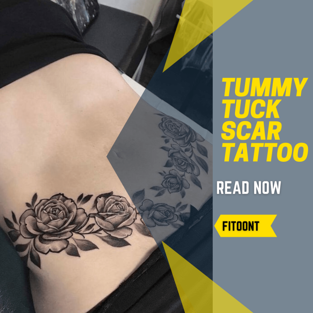 Tummy Tuck Scar Tattoo