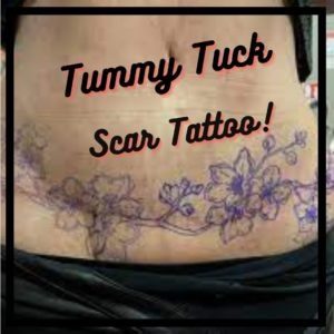 tummy tuck tattoo