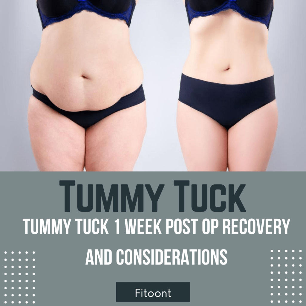 Tummy Tuck 1 Week Post Op