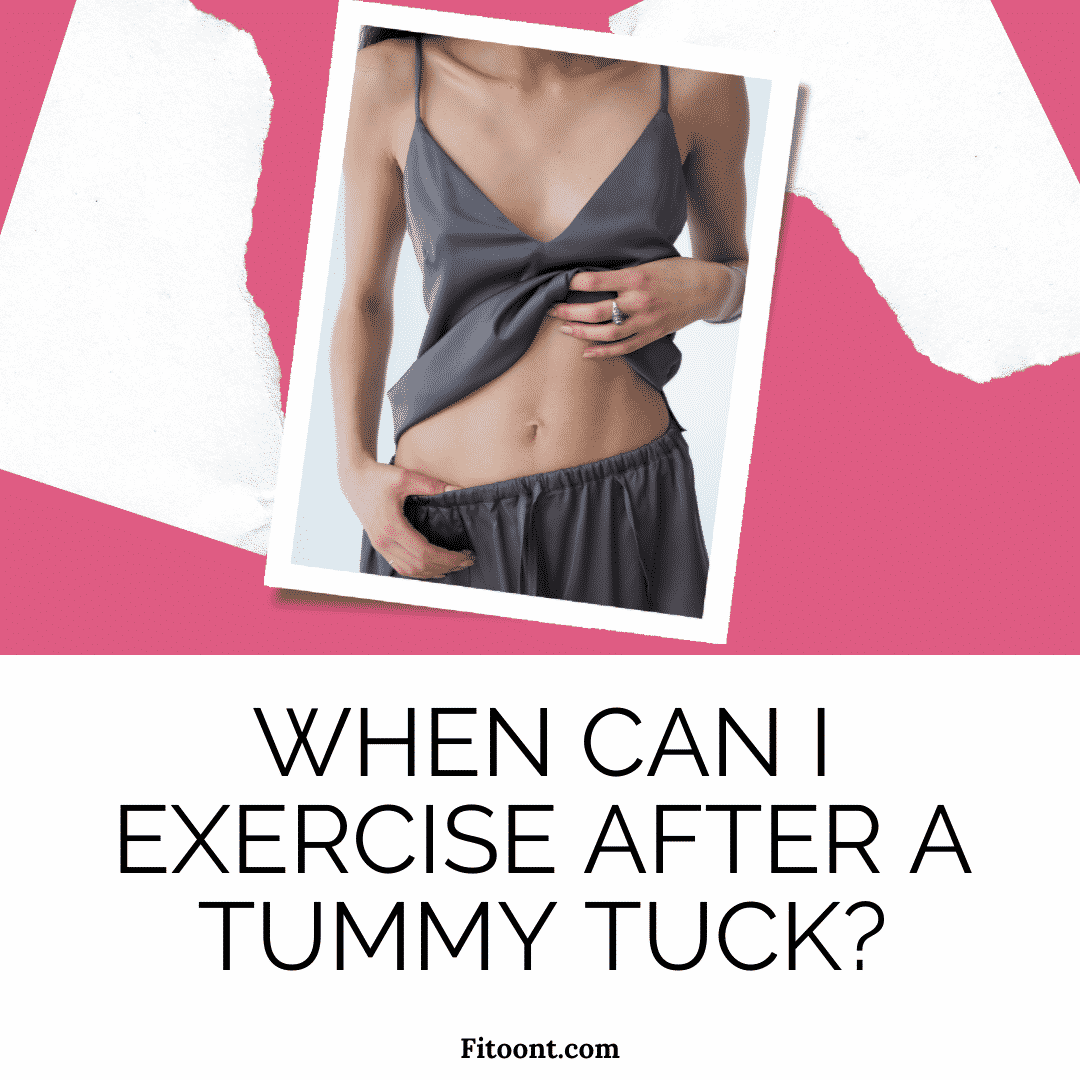 When can I exercise after a tummy tuck?