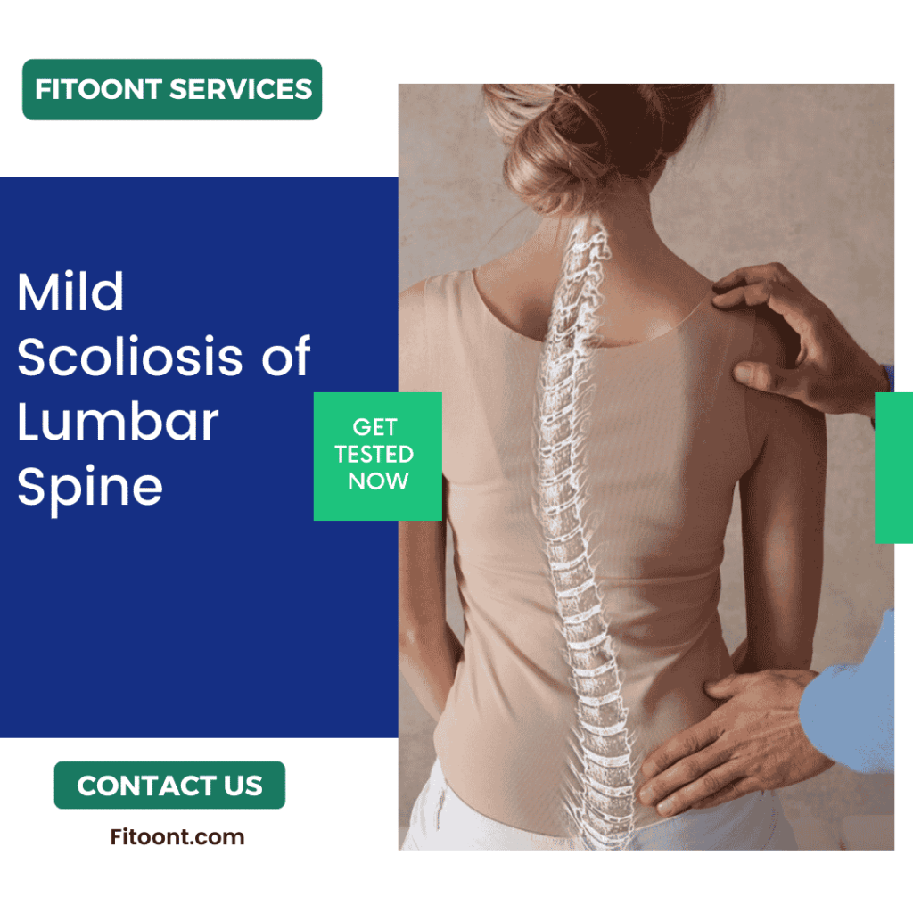 mild scoliosis of lumbar spine